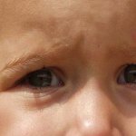 Wie behandelt man Gerste bei Kindern?