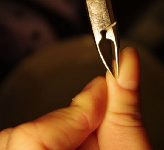 Nagelhautentfernung