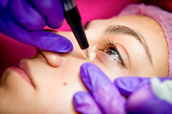 Permanent Make-up zum Verstecken von Prellungen unter den Augen