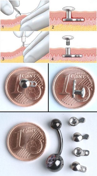 Microdermales Piercing: Wie Mikrodermabras gemacht werden (Foto)