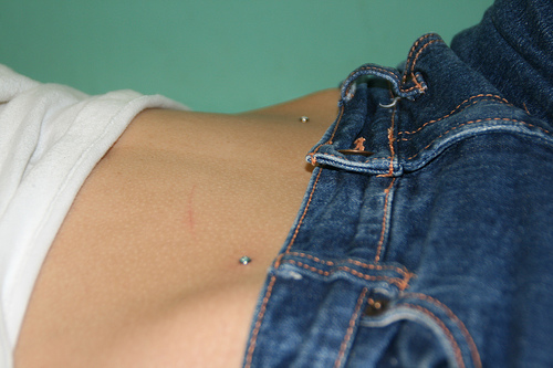 Microdermales Piercing: Wie Mikrodermabras gemacht werden (Foto)