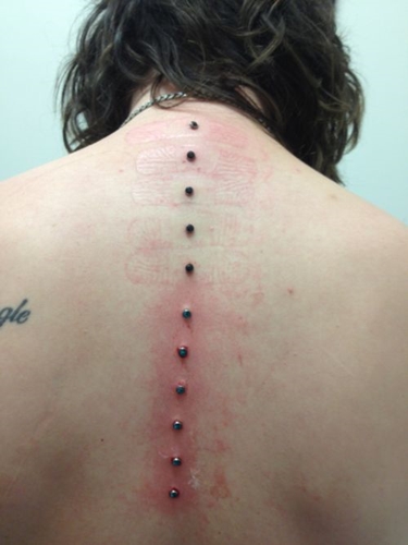 Microdermales Piercing: Wie Mikrodermabras gemacht werden (Foto)