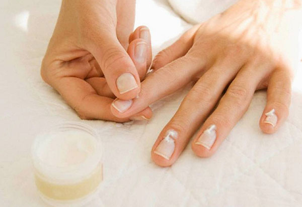 Fünf häufige Nagelprobleme: Ursachen und Lösungen