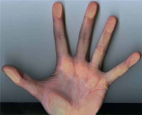 Die Hochzeitslinie auf der Hand