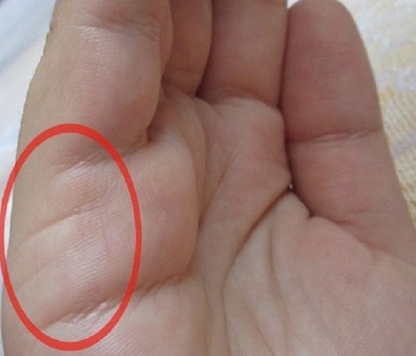 Die Hochzeitslinie auf der Hand