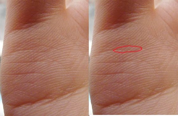 Die Hochzeitslinie auf der Hand