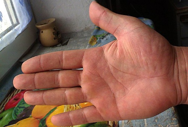 Die Hochzeitslinie auf der Hand