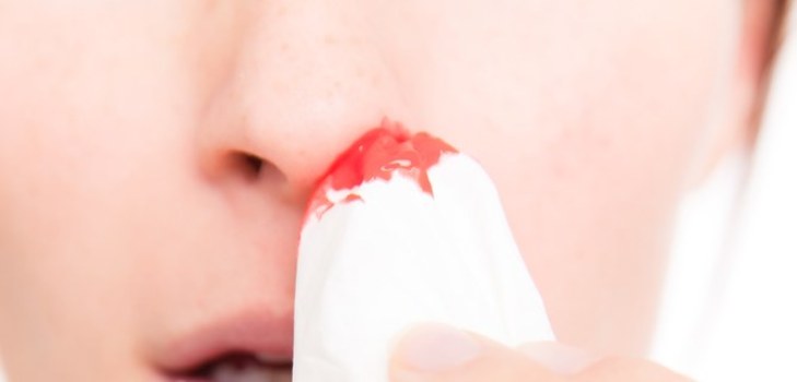 Blut aus der Nase