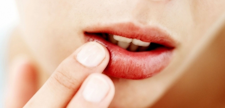 Rezepte zur Behandlung von Erkältungen auf den Lippen