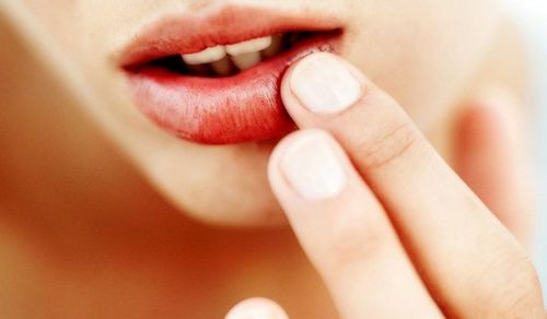  Eine schnelle und effektive Behandlung von Erkältungen auf den Lippen: einfache Rezepte