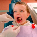 Wie man Stomatitis heilt